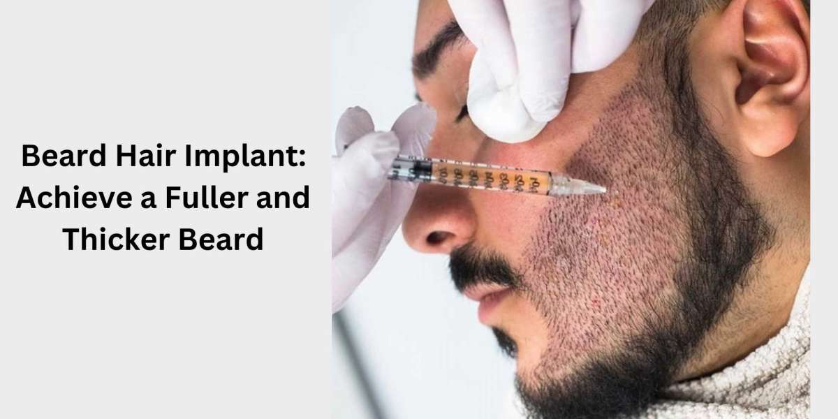 Beard Hair Implant: Achieve a Fuller and Thicker Beard