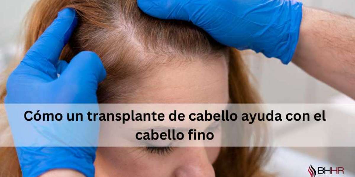 Cómo un transplante de cabello ayuda con el cabello fino