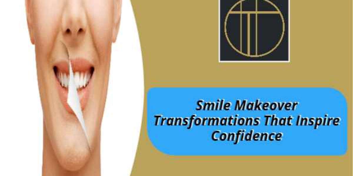 Smile Makeover Transformations That Inspire Confidence