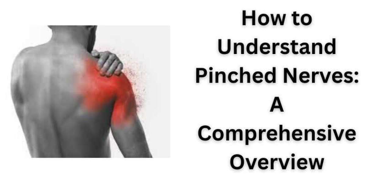 How to Understand Pinched Nerves: A Comprehensive Overview